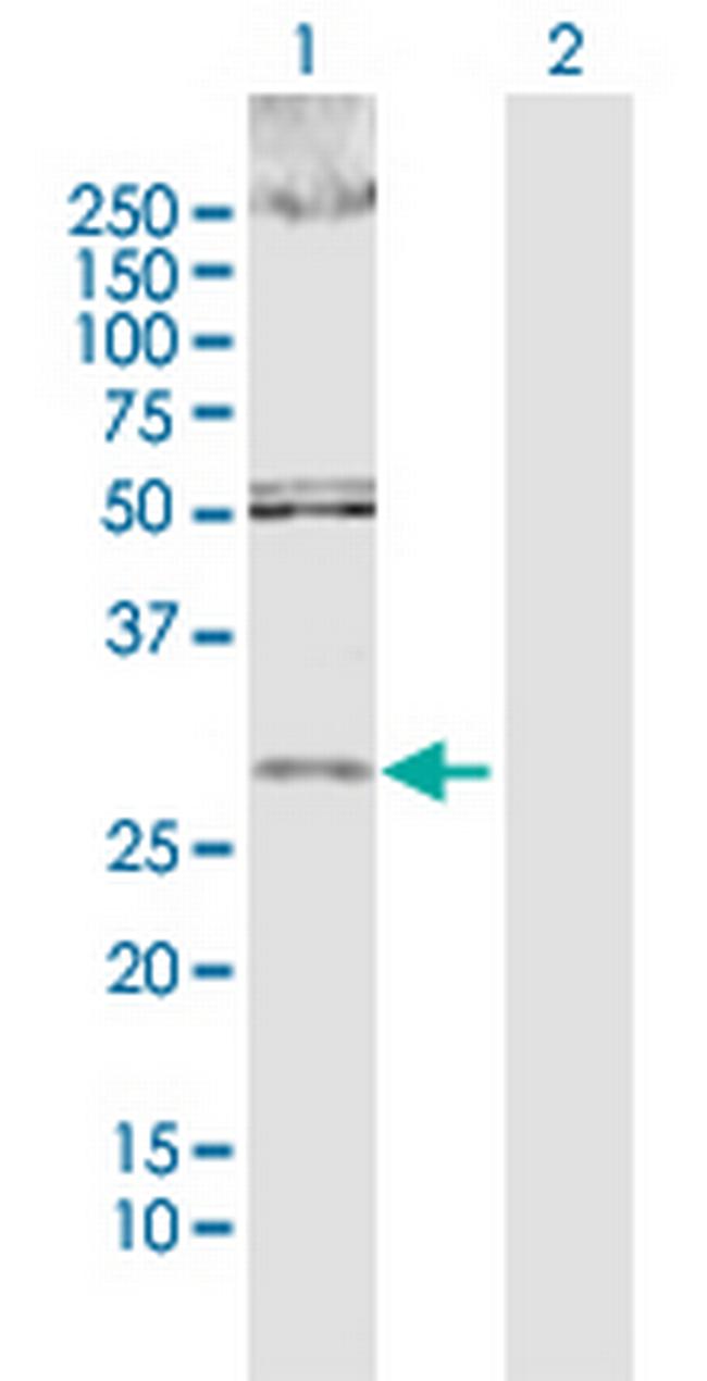 DKK1 Antibody in Western Blot (WB)