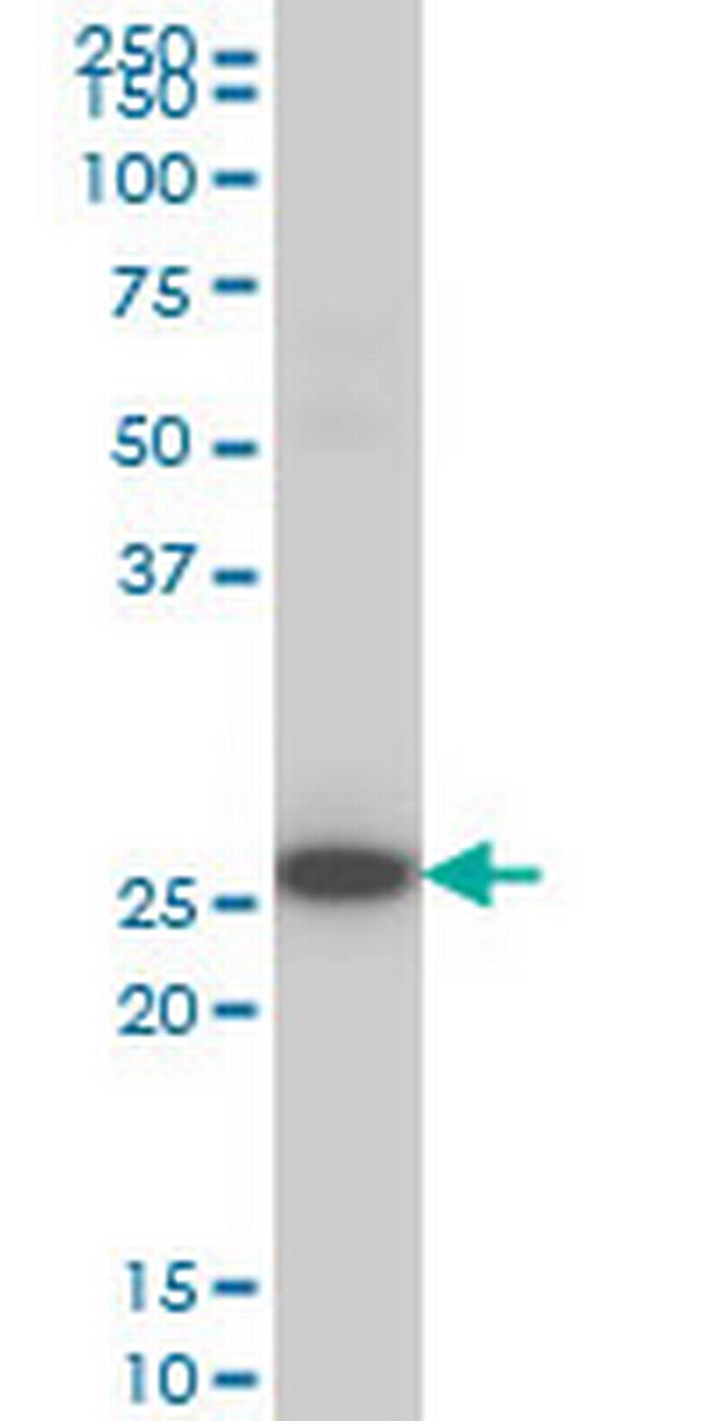 DKK1 Antibody in Western Blot (WB)