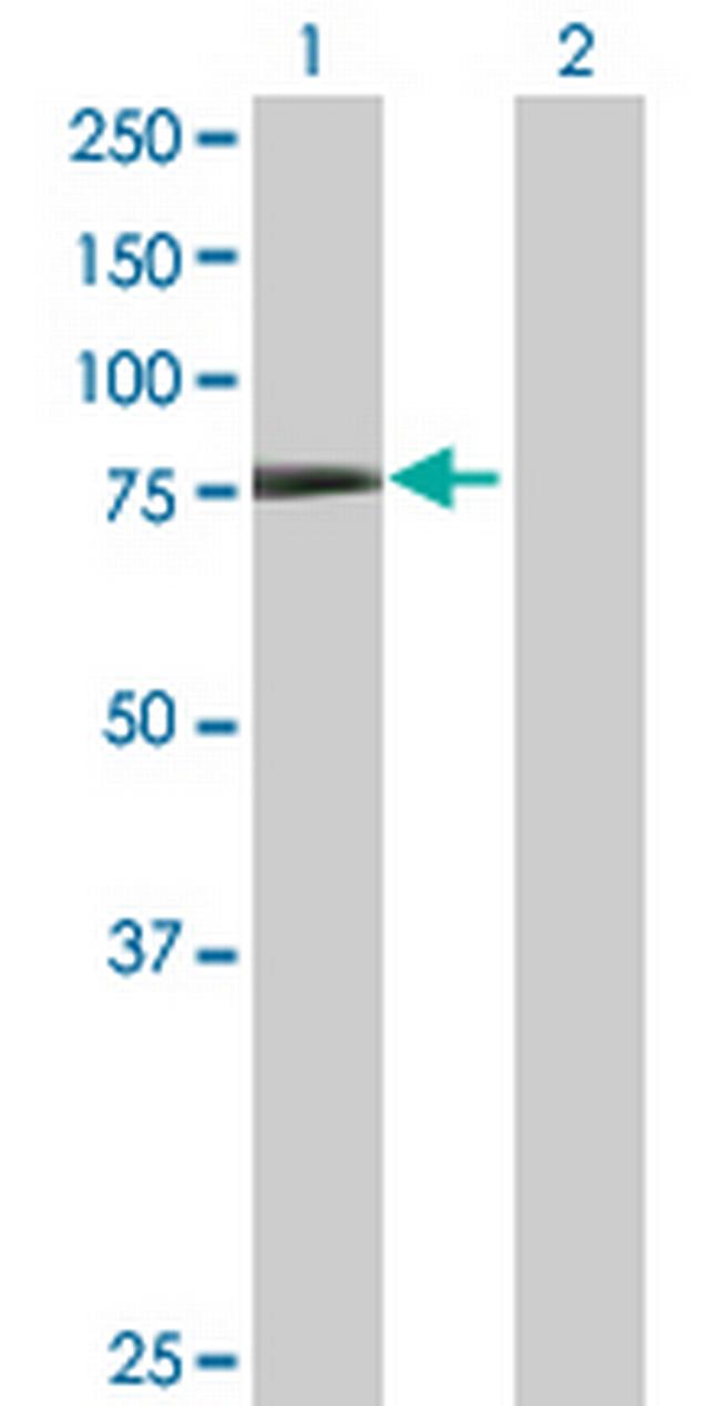 TRIM32 Antibody in Western Blot (WB)