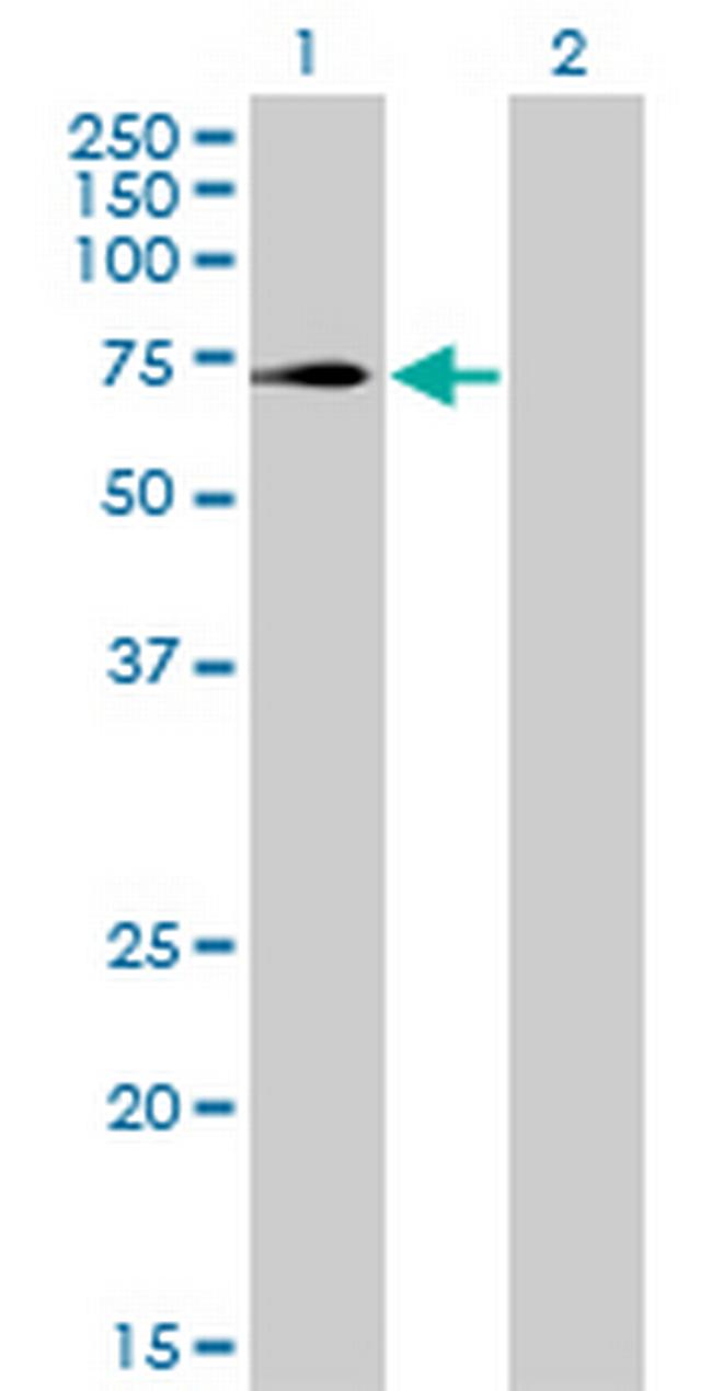 TRIM32 Antibody in Western Blot (WB)