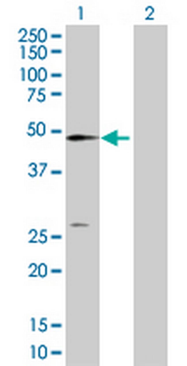 NT5C2 Antibody in Western Blot (WB)