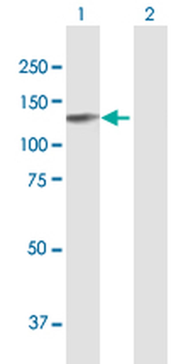 EPB41L3 Antibody in Western Blot (WB)