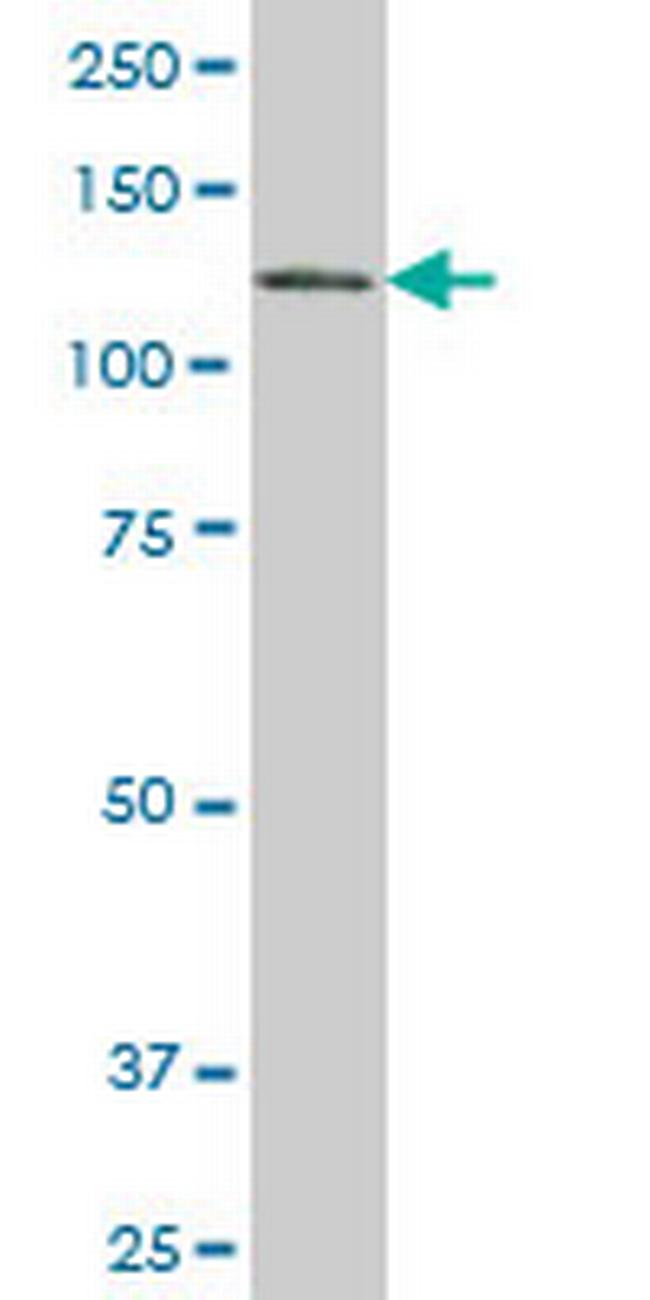 EPB41L3 Antibody in Western Blot (WB)