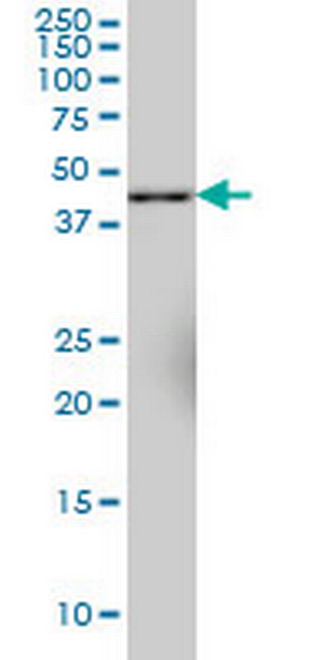 SYT11 Antibody in Western Blot (WB)