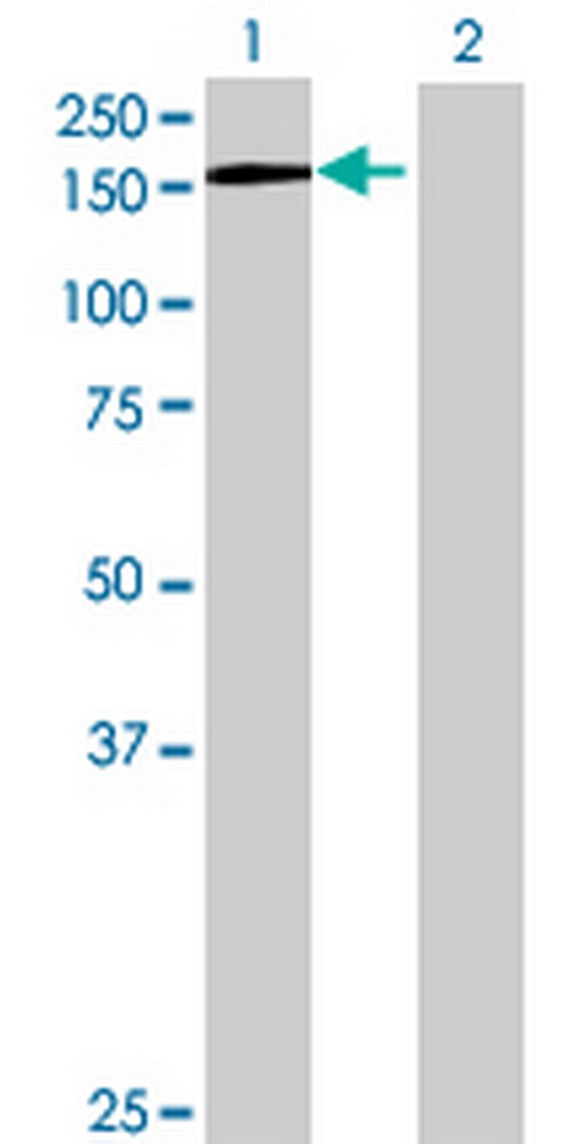 AGTPBP1 Antibody in Western Blot (WB)