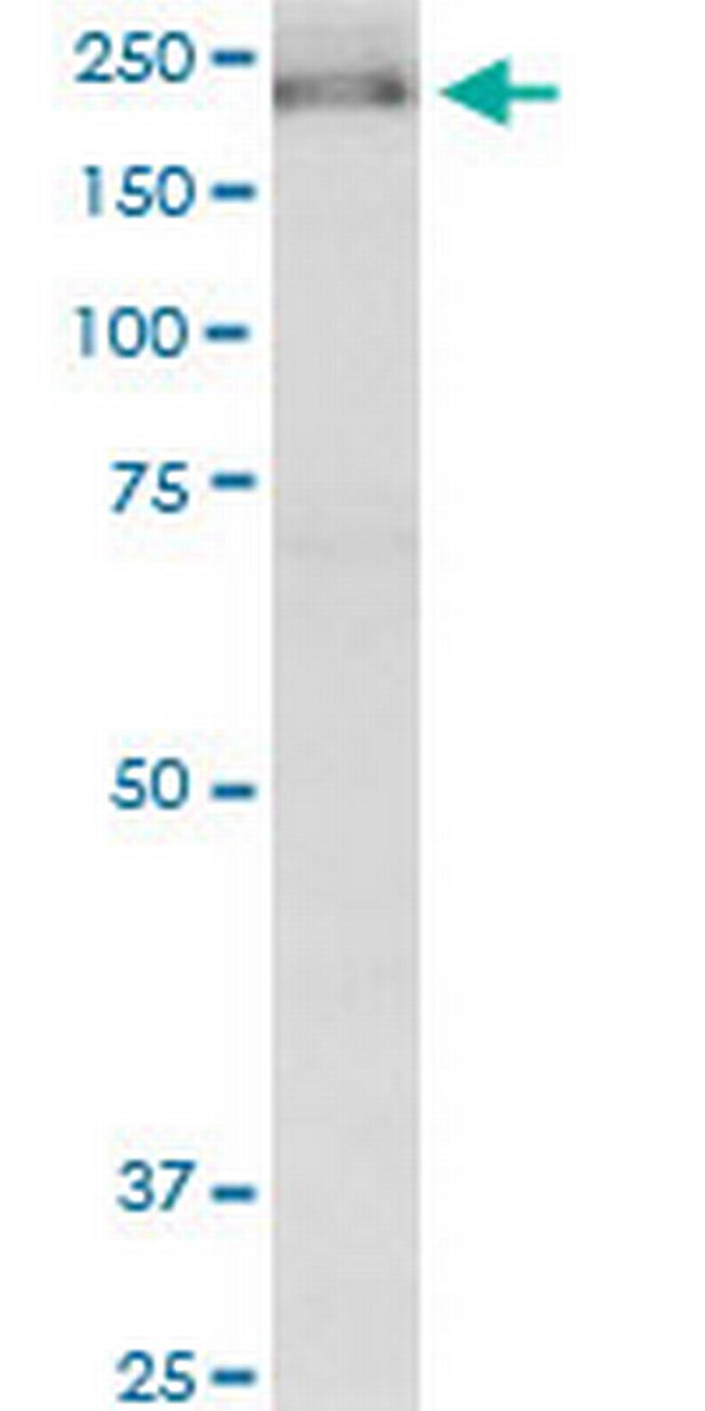 KIF13B Antibody in Western Blot (WB)