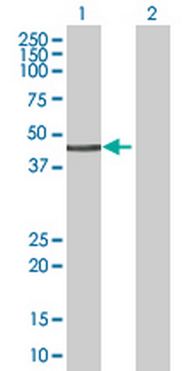 UBR2 Antibody in Western Blot (WB)