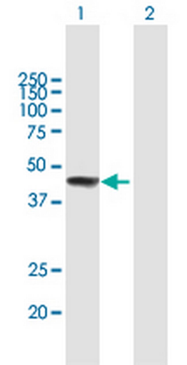 ZCCHC11 Antibody in Western Blot (WB)