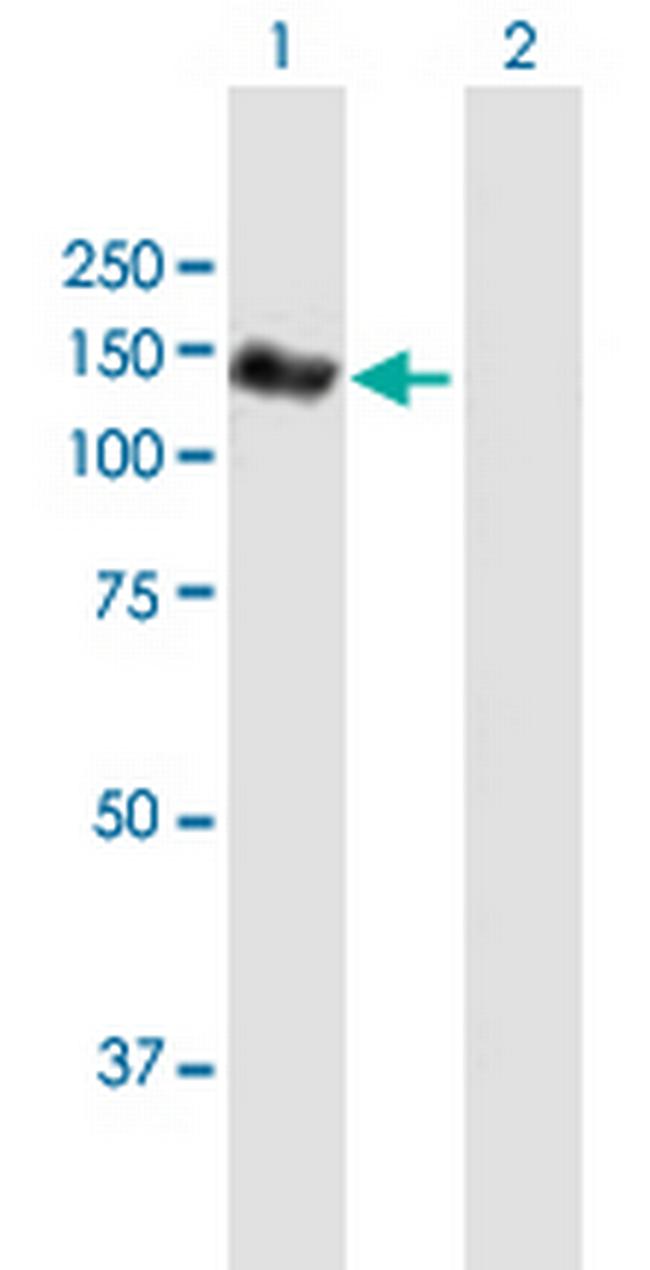 NEDD4L Antibody in Western Blot (WB)