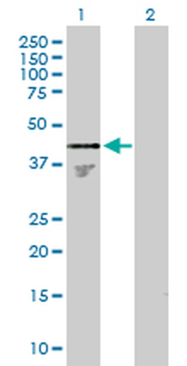 PHF15 Antibody in Western Blot (WB)