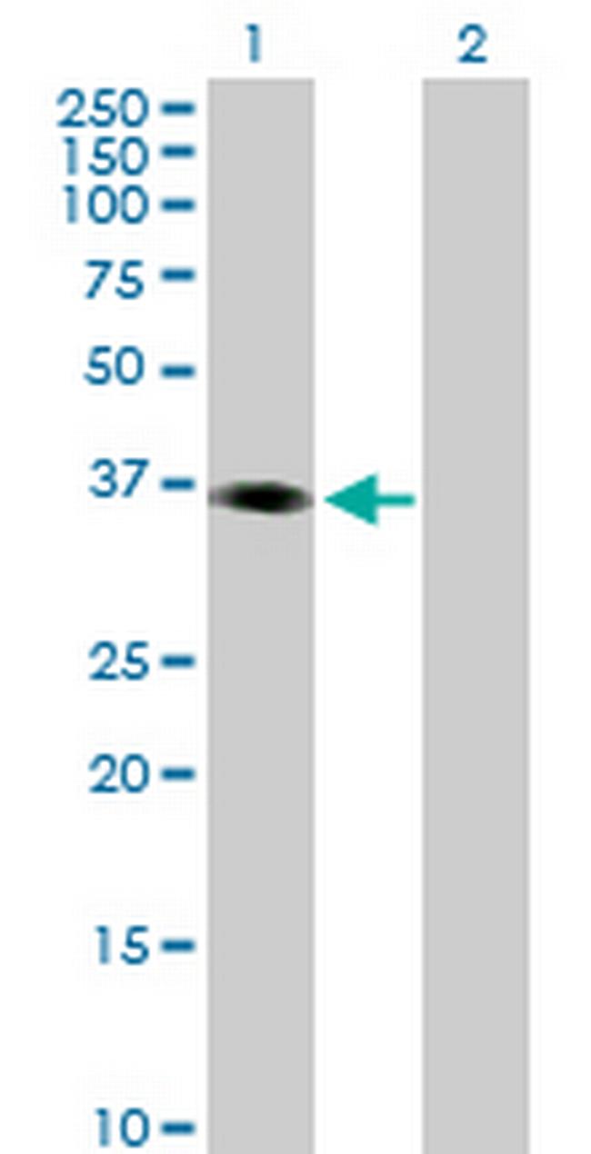 PHF15 Antibody in Western Blot (WB)