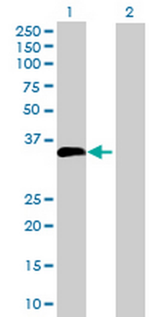 UNC84A Antibody in Western Blot (WB)