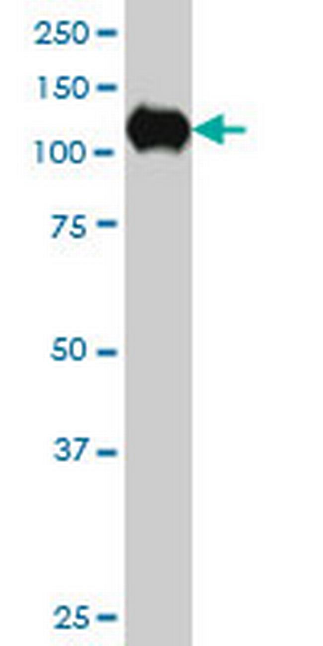 SIRT1 Antibody in Western Blot (WB)