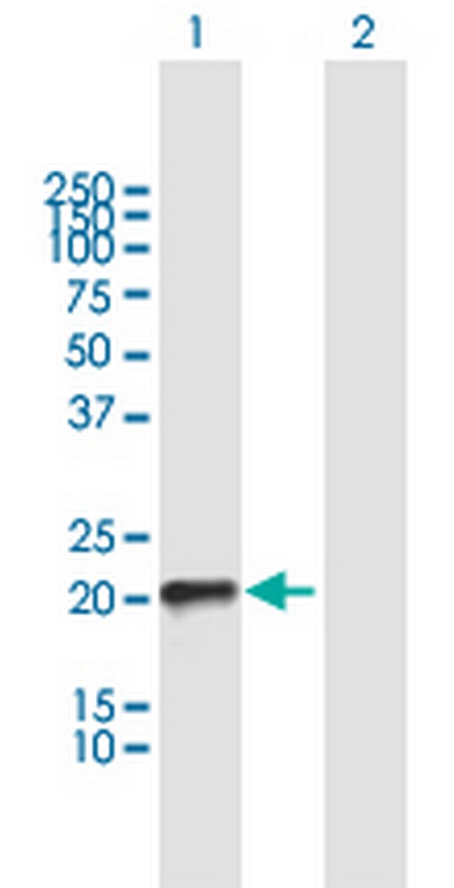 RHOQ Antibody in Western Blot (WB)