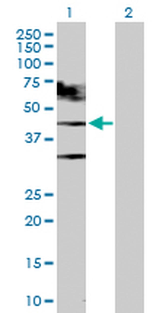 TARDBP Antibody in Western Blot (WB)