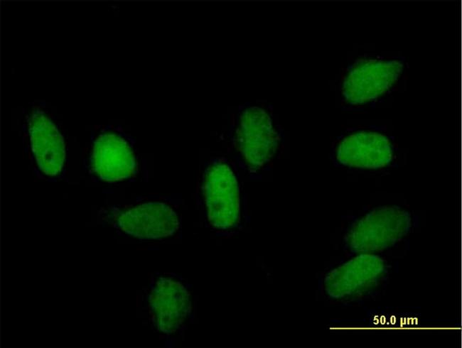 CBX5 Antibody in Immunocytochemistry (ICC/IF)