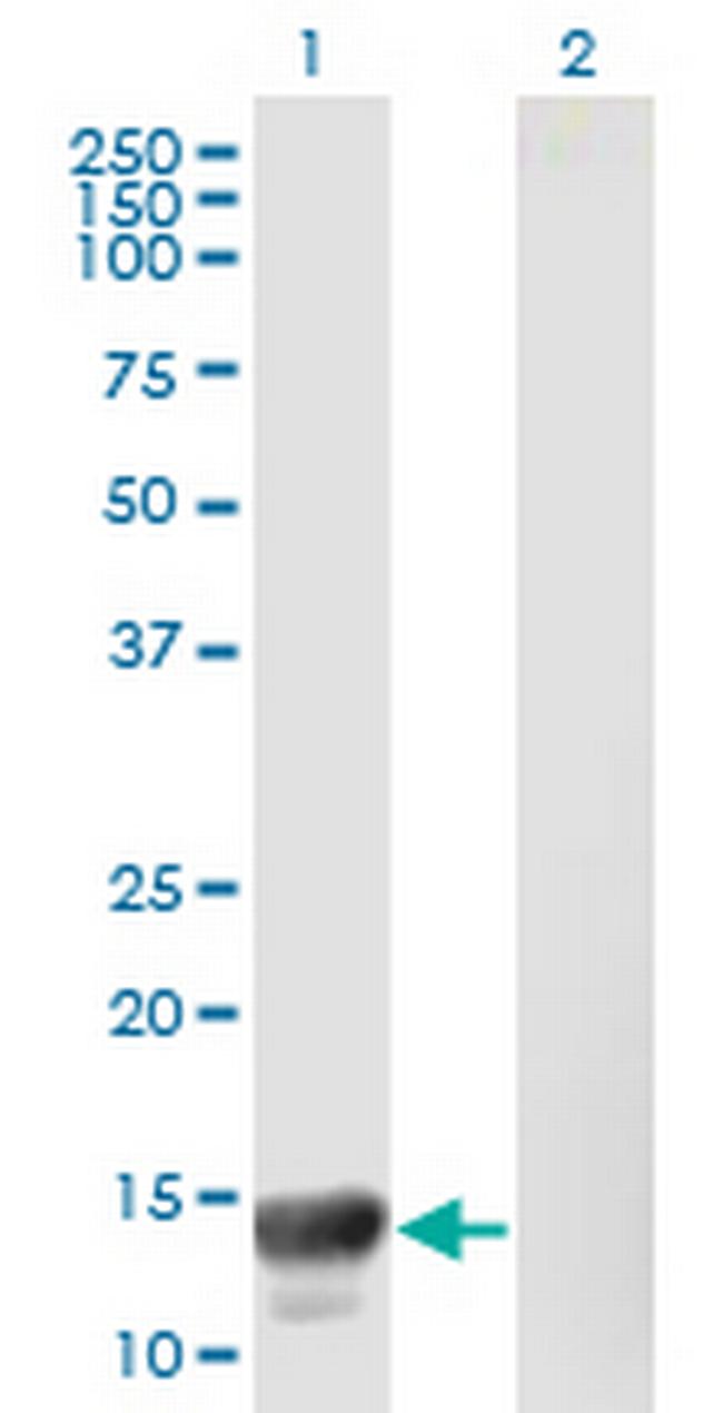 MACF1 Antibody in Western Blot (WB)