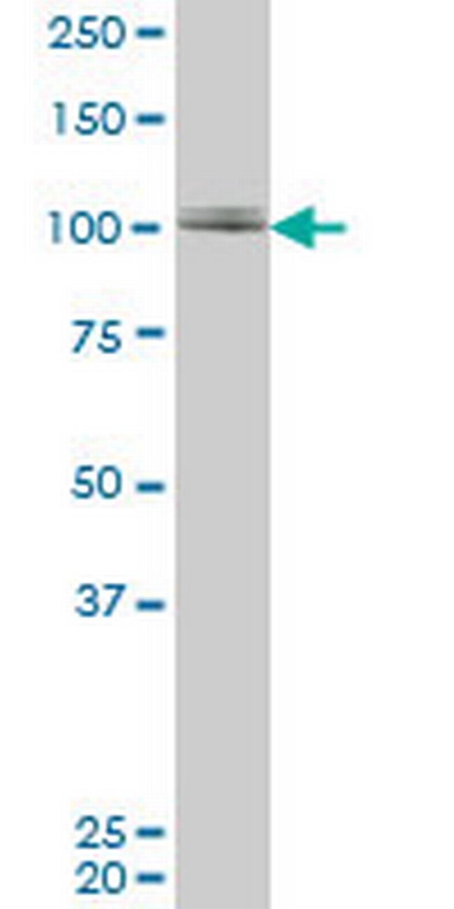 ZNF281 Antibody in Western Blot (WB)