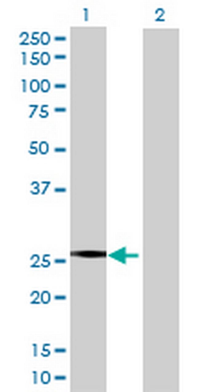 NNT Antibody in Western Blot (WB)