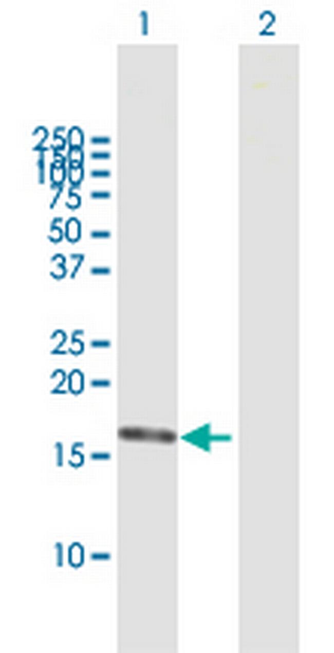 DNPEP Antibody in Western Blot (WB)