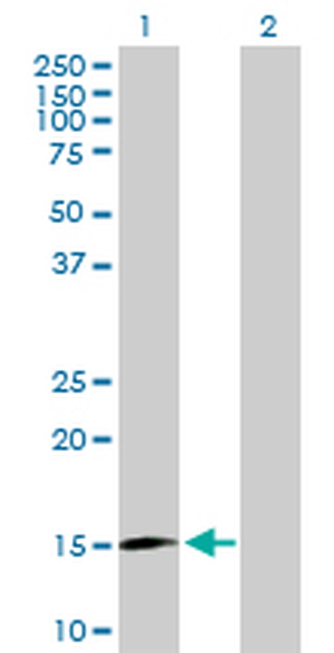 DNPEP Antibody in Western Blot (WB)