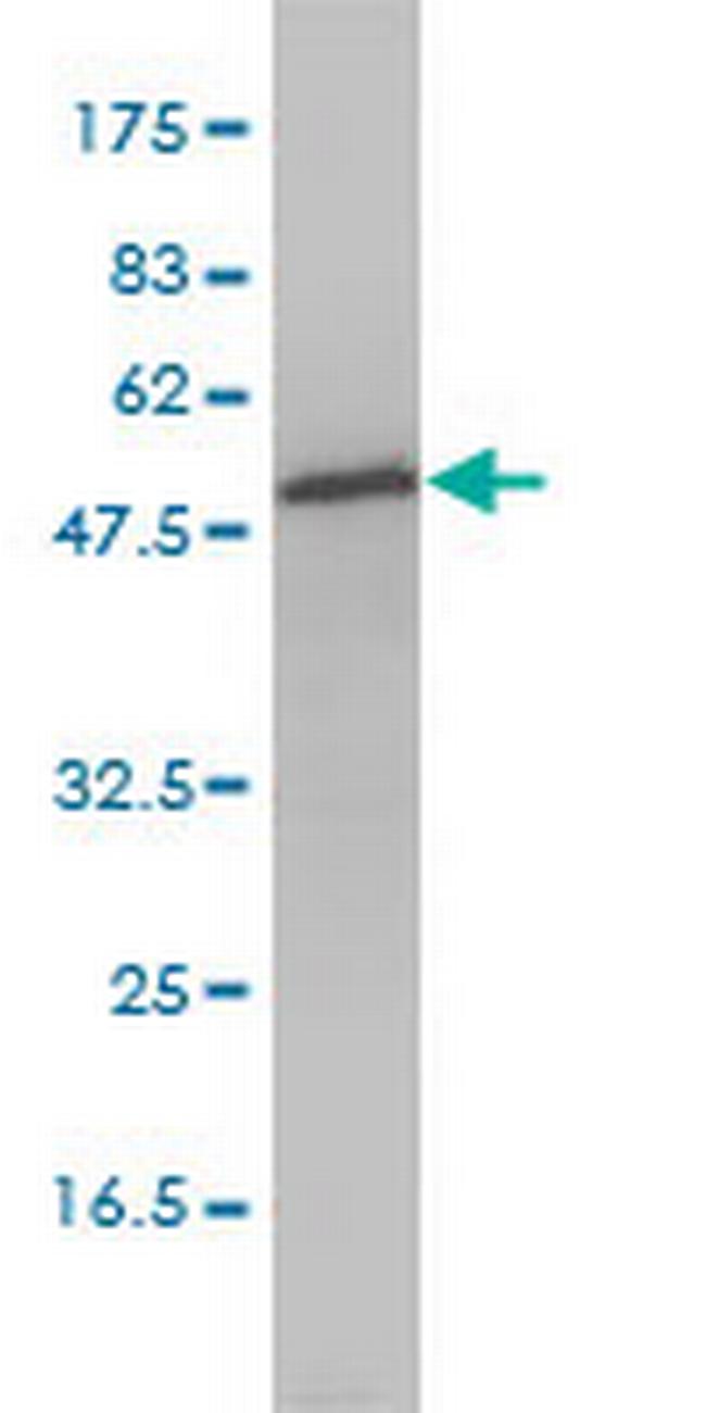 DNPEP Antibody in Western Blot (WB)