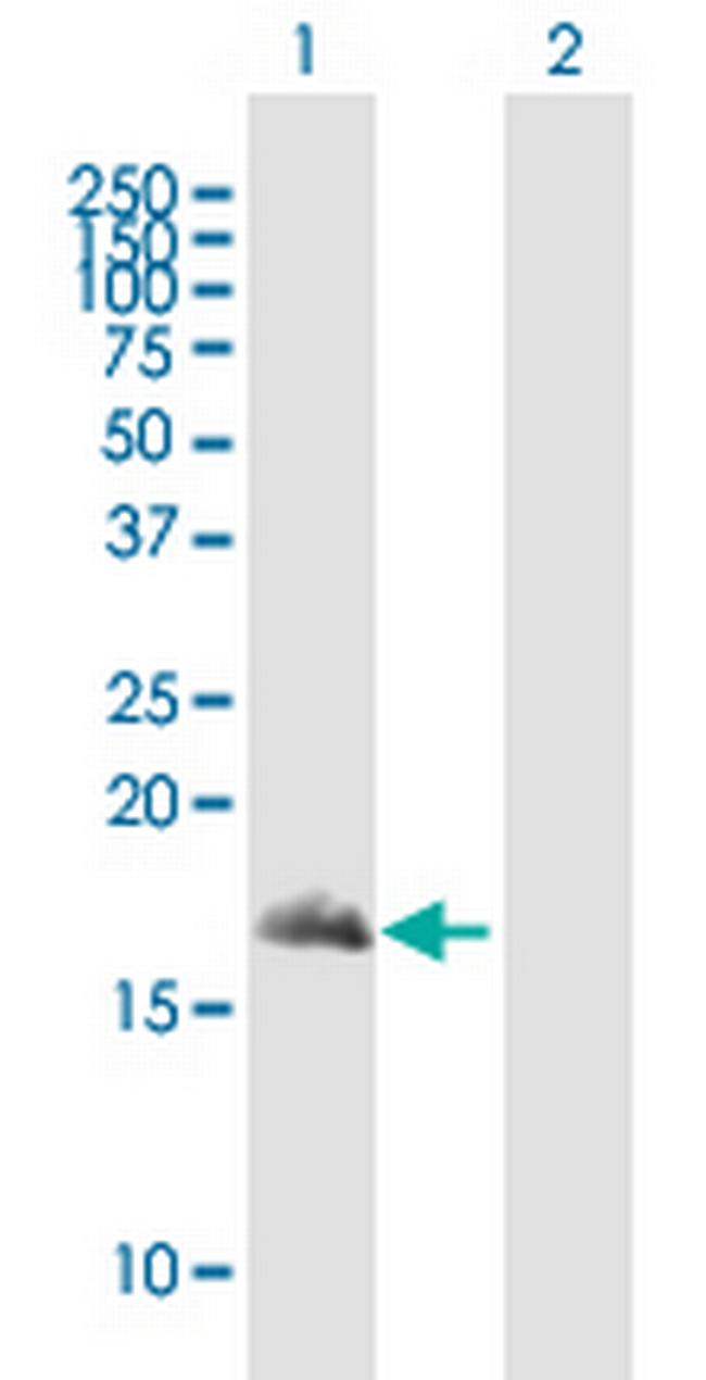 SNAPIN Antibody in Western Blot (WB)