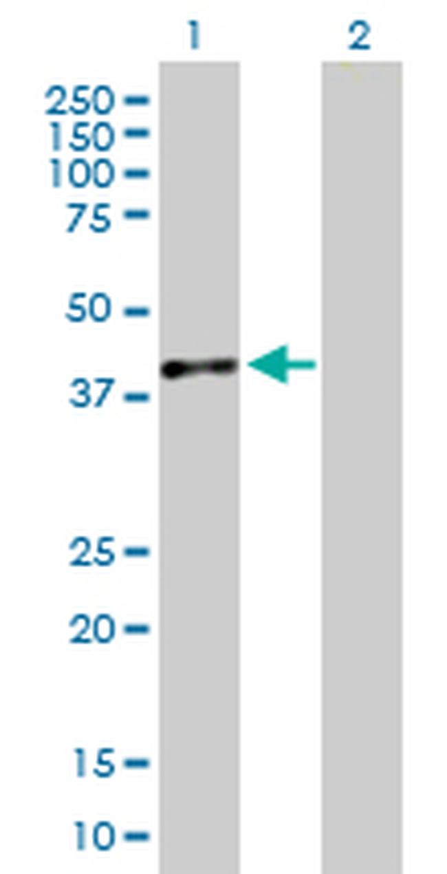 DDAH1 Antibody in Western Blot (WB)