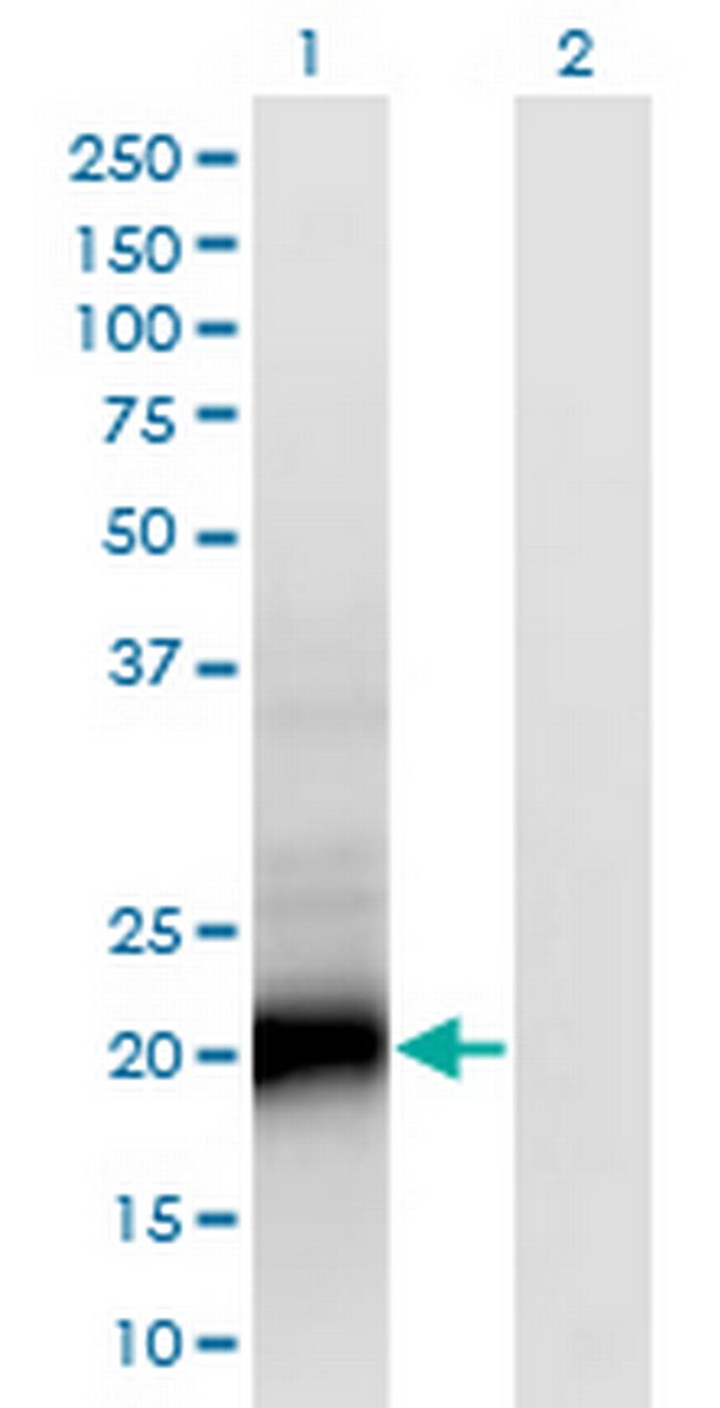 SMUG1 Antibody in Western Blot (WB)