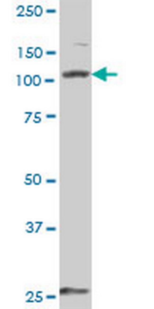 DDX58 Antibody in Western Blot (WB)