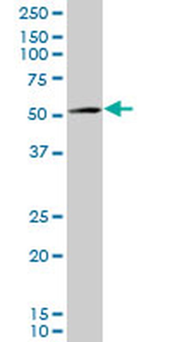 AMACR Antibody in Western Blot (WB)