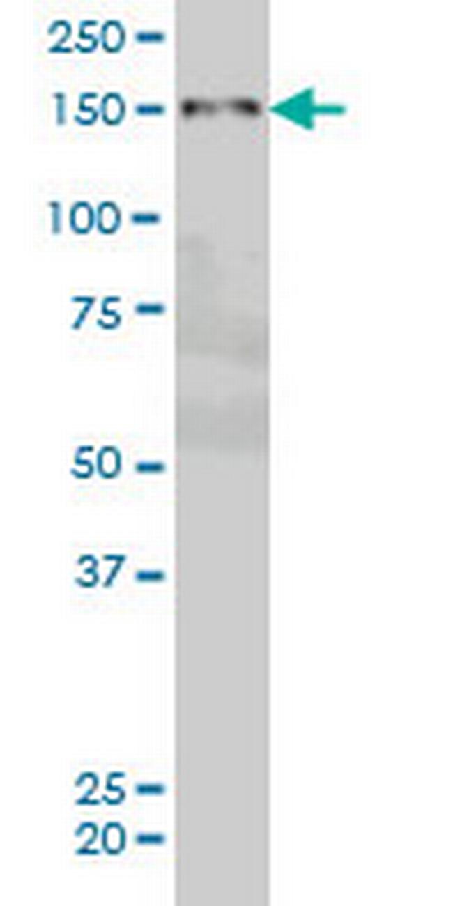 ZMYND8 Antibody in Western Blot (WB)