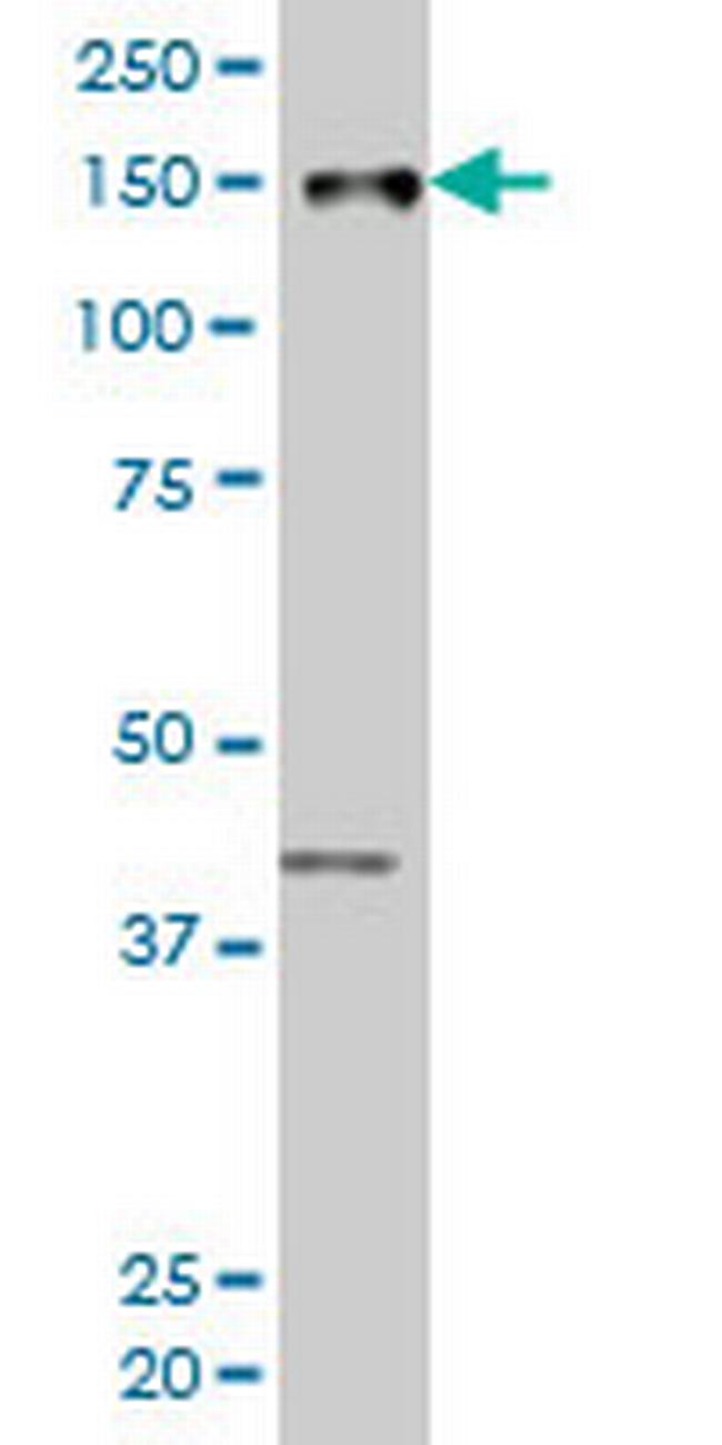 ZMYND8 Antibody in Western Blot (WB)