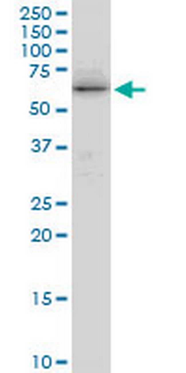 TRIM29 Antibody in Western Blot (WB)