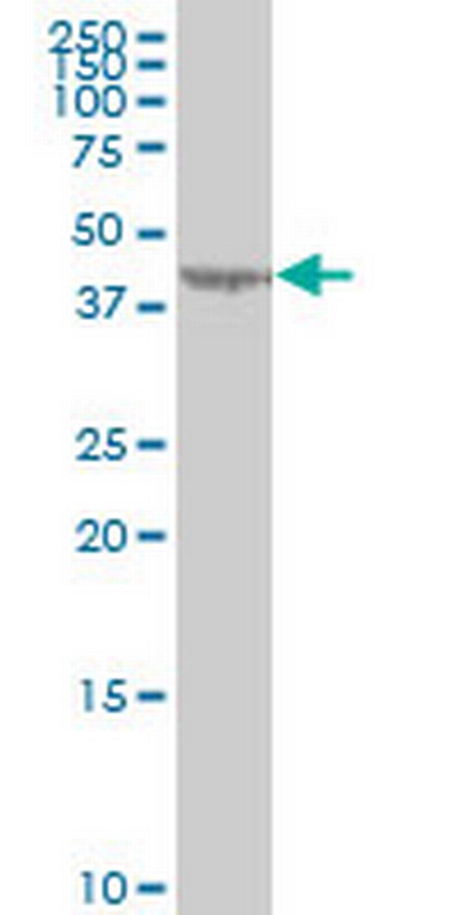 LYPLA3 Antibody in Western Blot (WB)