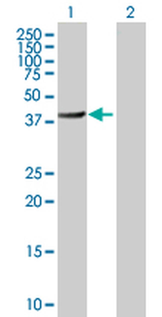 BHMT2 Antibody in Western Blot (WB)