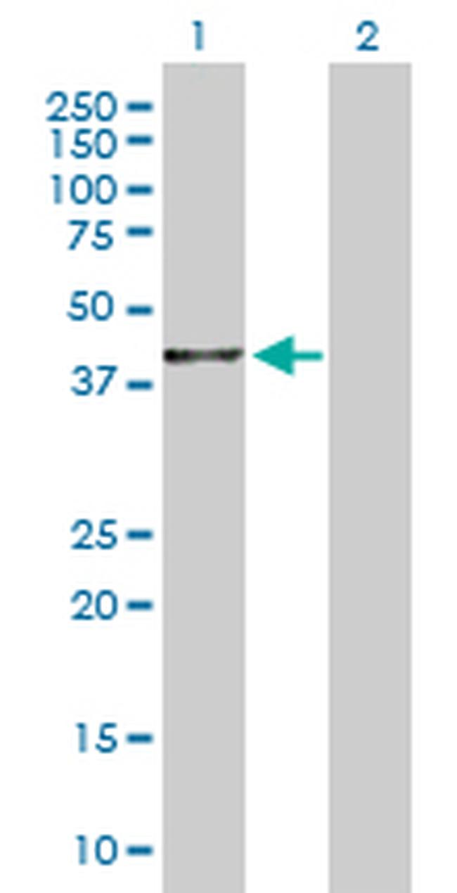 BHMT2 Antibody in Western Blot (WB)