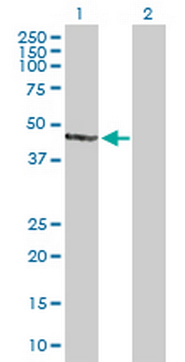 AIPL1 Antibody in Western Blot (WB)