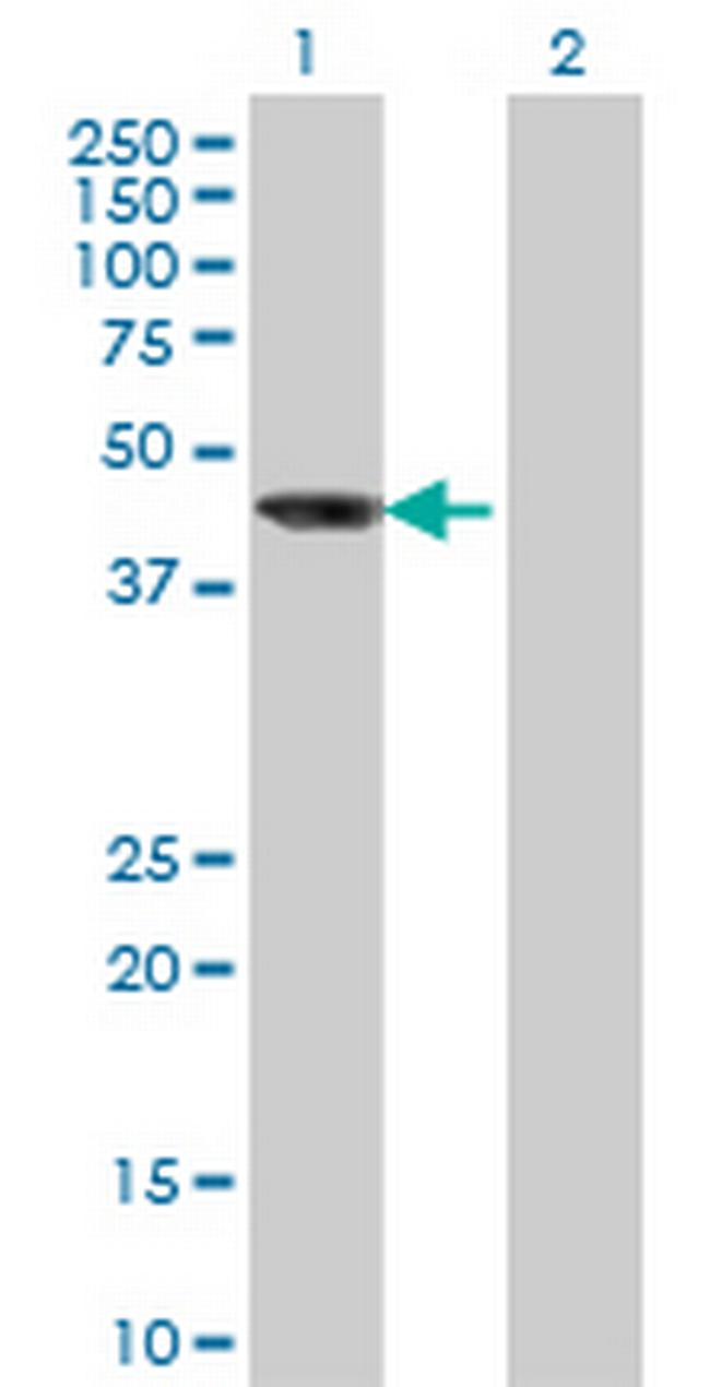 AIPL1 Antibody in Western Blot (WB)