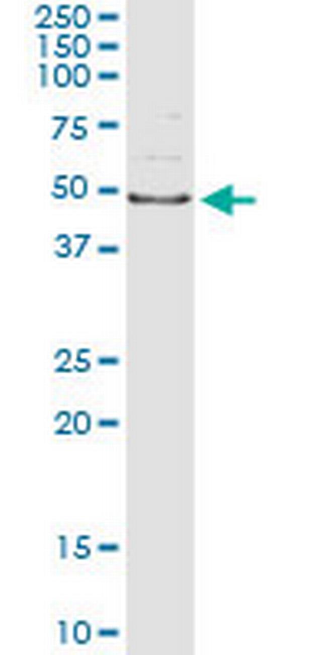 AIPL1 Antibody in Immunoprecipitation (IP)