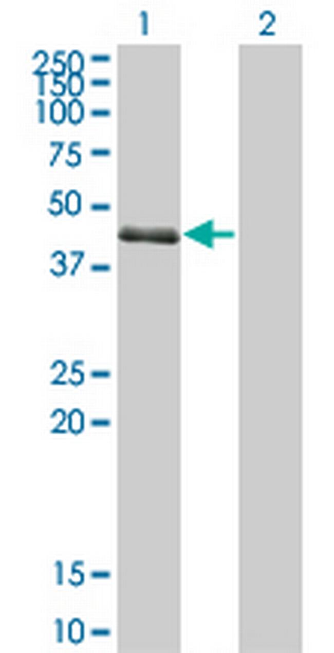 SPDEF Antibody in Western Blot (WB)