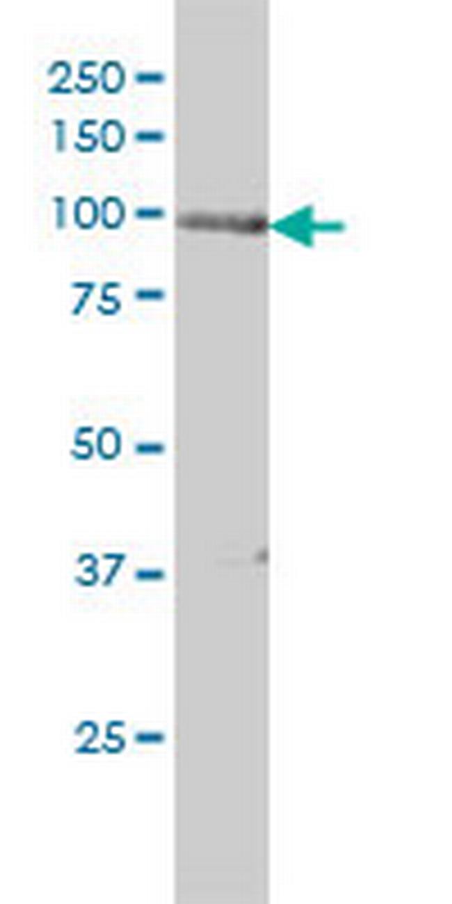 PRKD2 Antibody in Western Blot (WB)