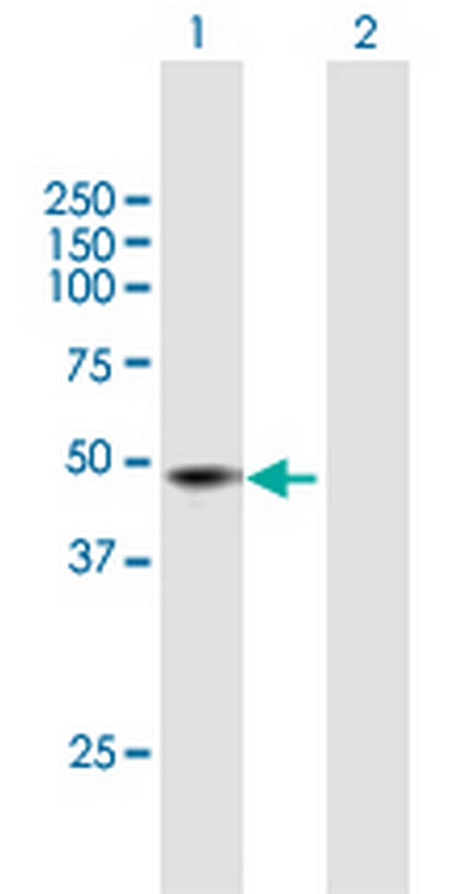 MR-1 Antibody in Western Blot (WB)