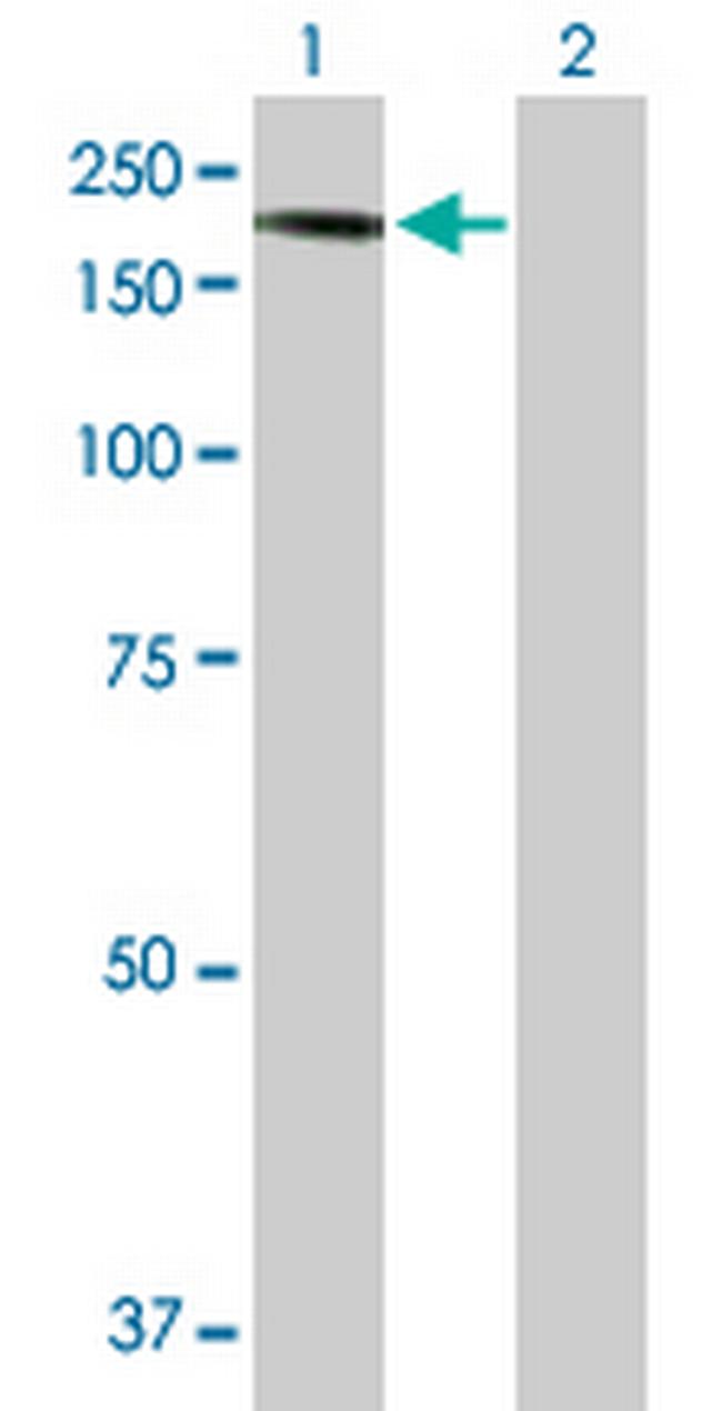 CNTNAP2 Antibody in Western Blot (WB)