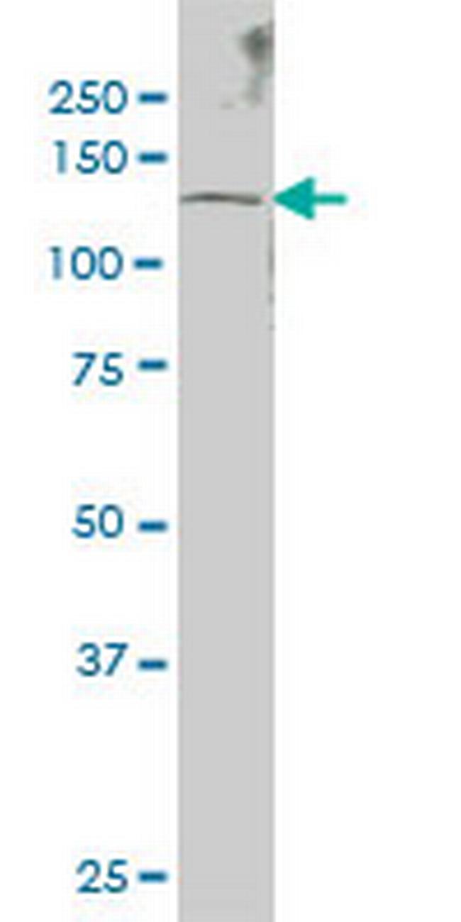 SENP6 Antibody in Western Blot (WB)