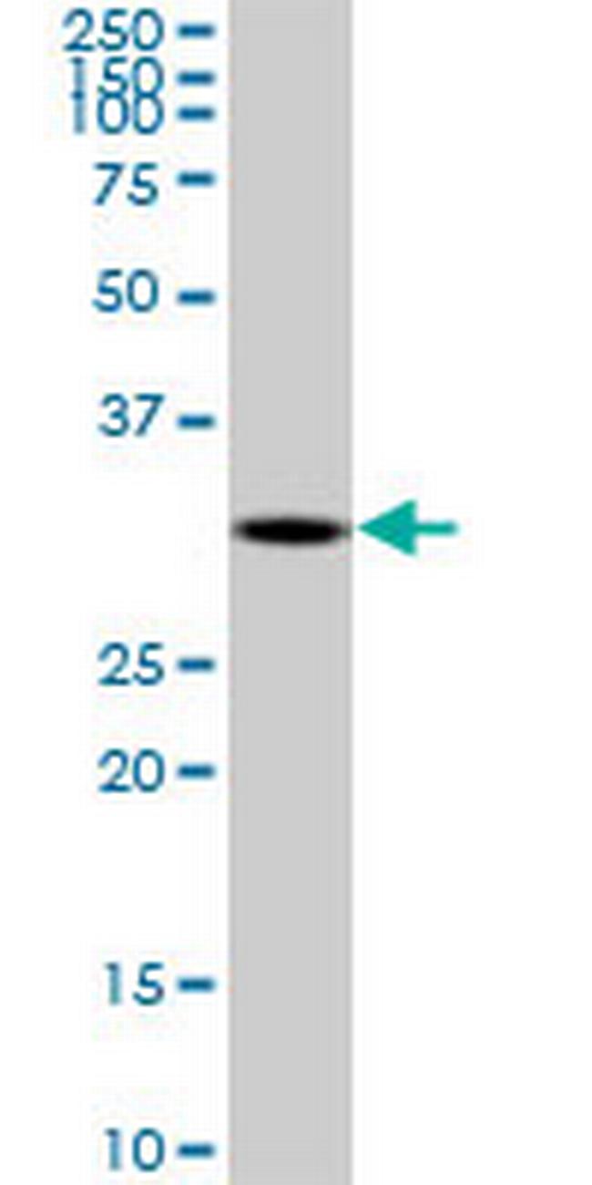 DECR2 Antibody in Western Blot (WB)