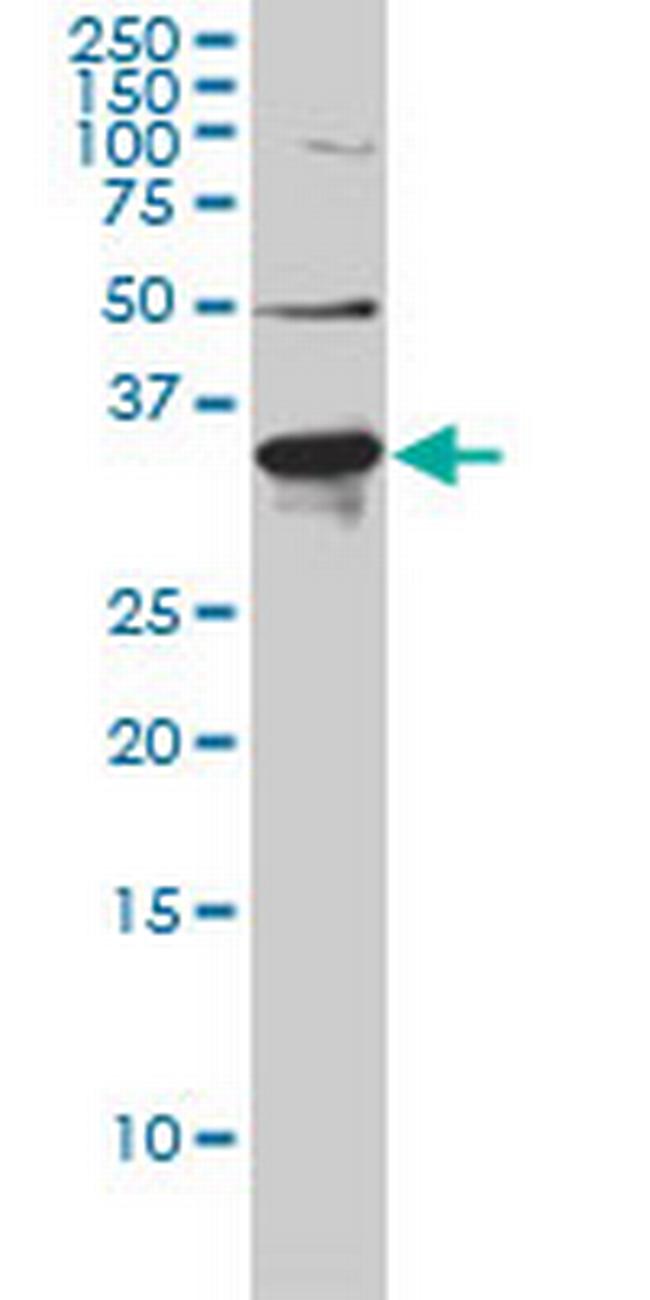 LDLRAP1 Antibody in Western Blot (WB)