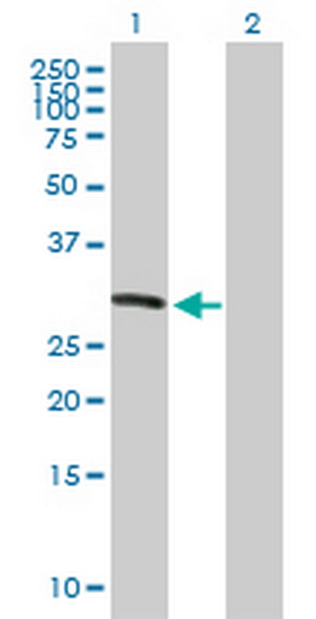 KIF26A Antibody in Western Blot (WB)