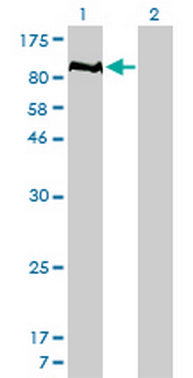 PTPN22 Antibody in Western Blot (WB)