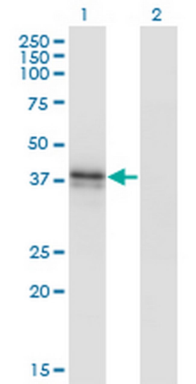 B3GAT3 Antibody in Western Blot (WB)